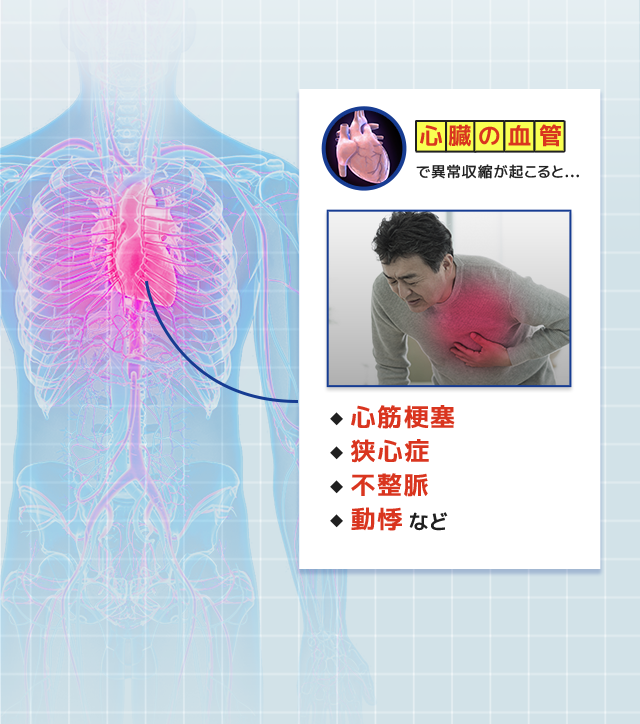心臓の血管で異常収縮が起こると…心筋梗塞、狭心症、不整脈、動悸などが起こる恐れが！