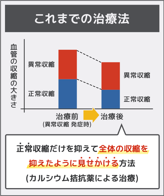 これまでの治療法。正常収縮だけを抑えて全体の収縮を抑えたように見せかける方法。（カルシウム拮抗薬による治療）