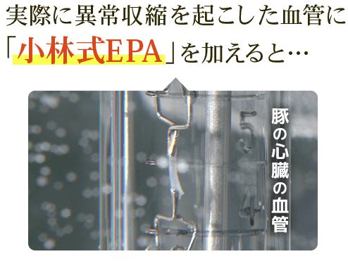 ※豚の心臓の血管
