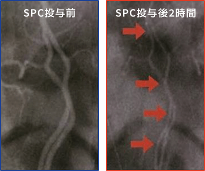 SPC投与後２時間の血管の様子