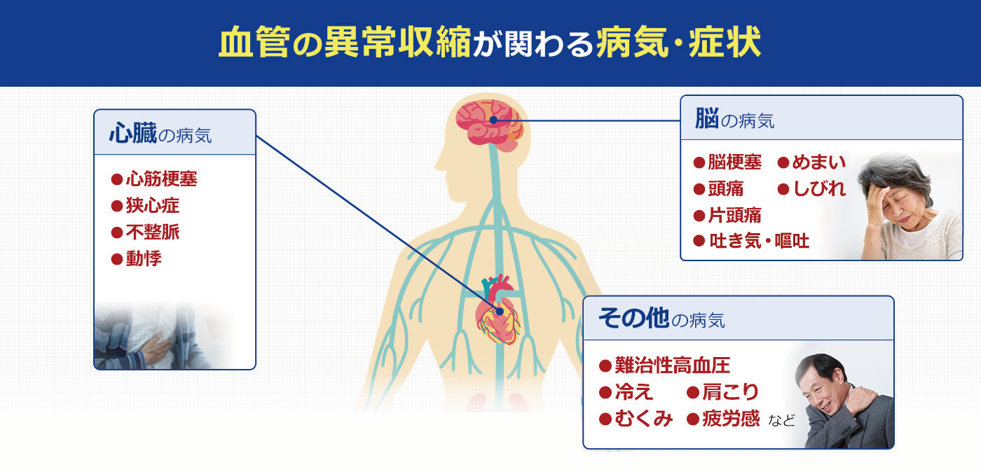 血管の異常収縮により危険な状態になった脳