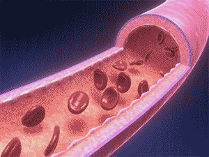 前触れもなく突然血管が縮んで、血流を滞らせてしまう異常な収縮